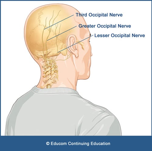 Unit 11 - Occipital Neuralgia@Informal-Headache-12H-U11-2021 ...