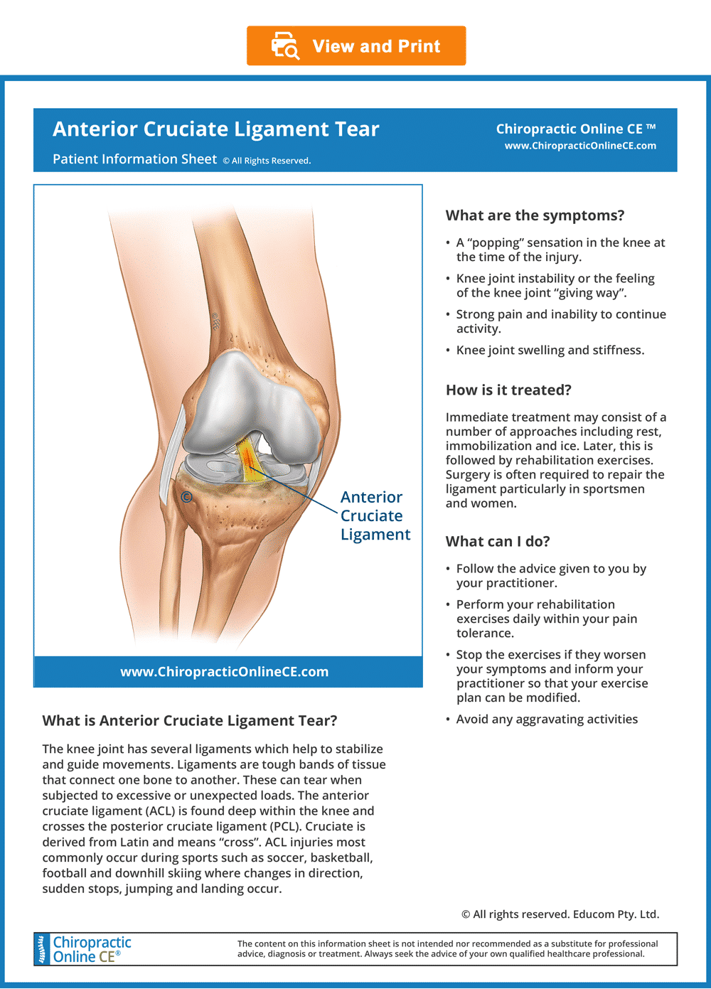 Anterior Cruciate Ligament Tear