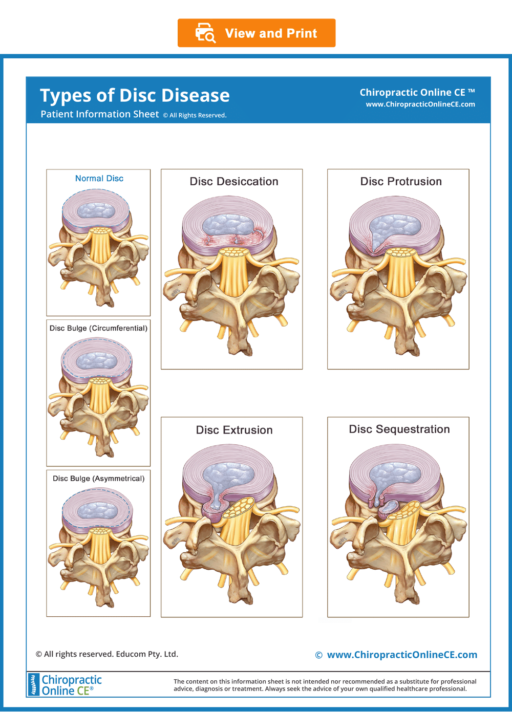 evaluating-a-patient-with-severe-low-back-and-bilateral-leg-pain-a