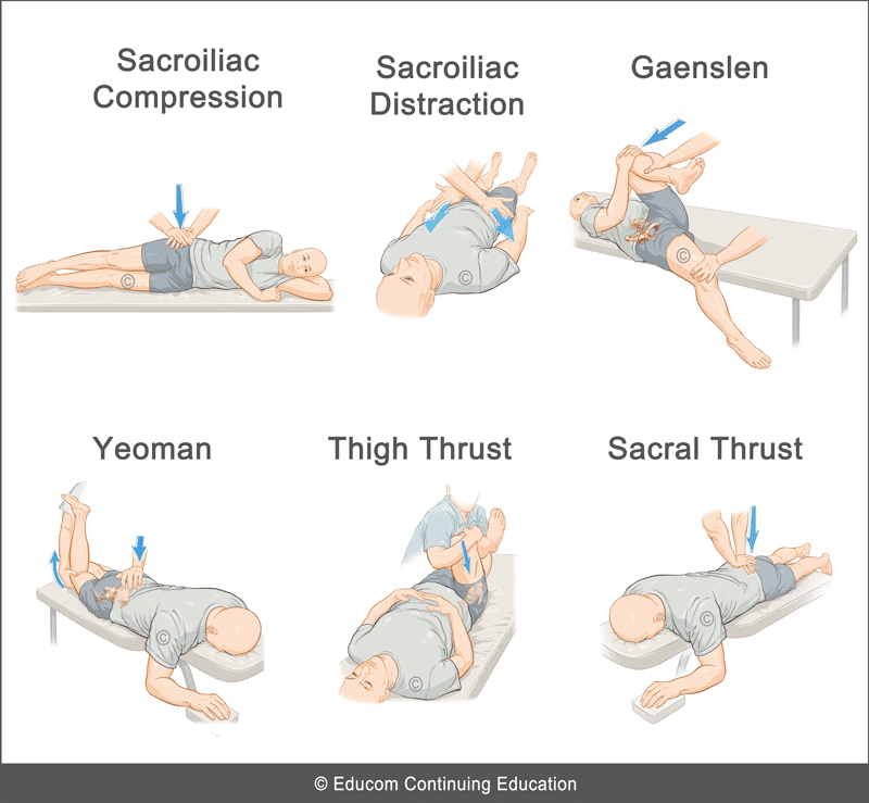 Unit 3 - Sacroiliac Joint Dysfunction@lifewest-b-u3-22 - Chiropractic 