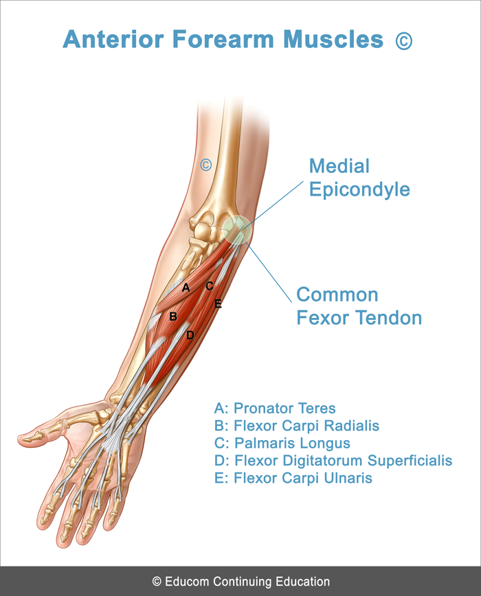 Unit 4 - Medial Elbow Tendinopathy (Golfer’s Elbow)@lifewest-msd-v1-10 ...