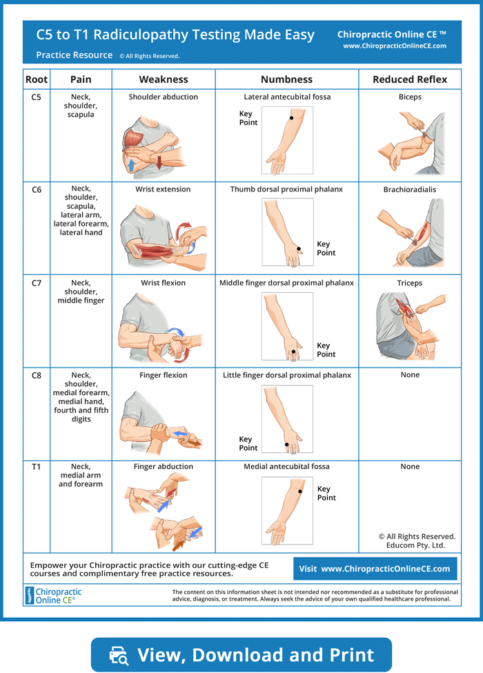 Cervical-Radiculopathy-Made-Easy