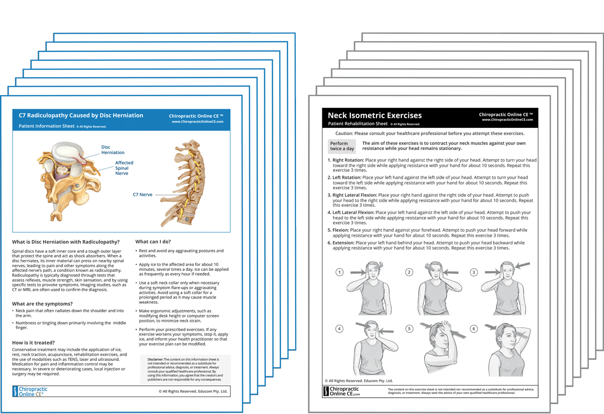 Cervical Radiculopathy